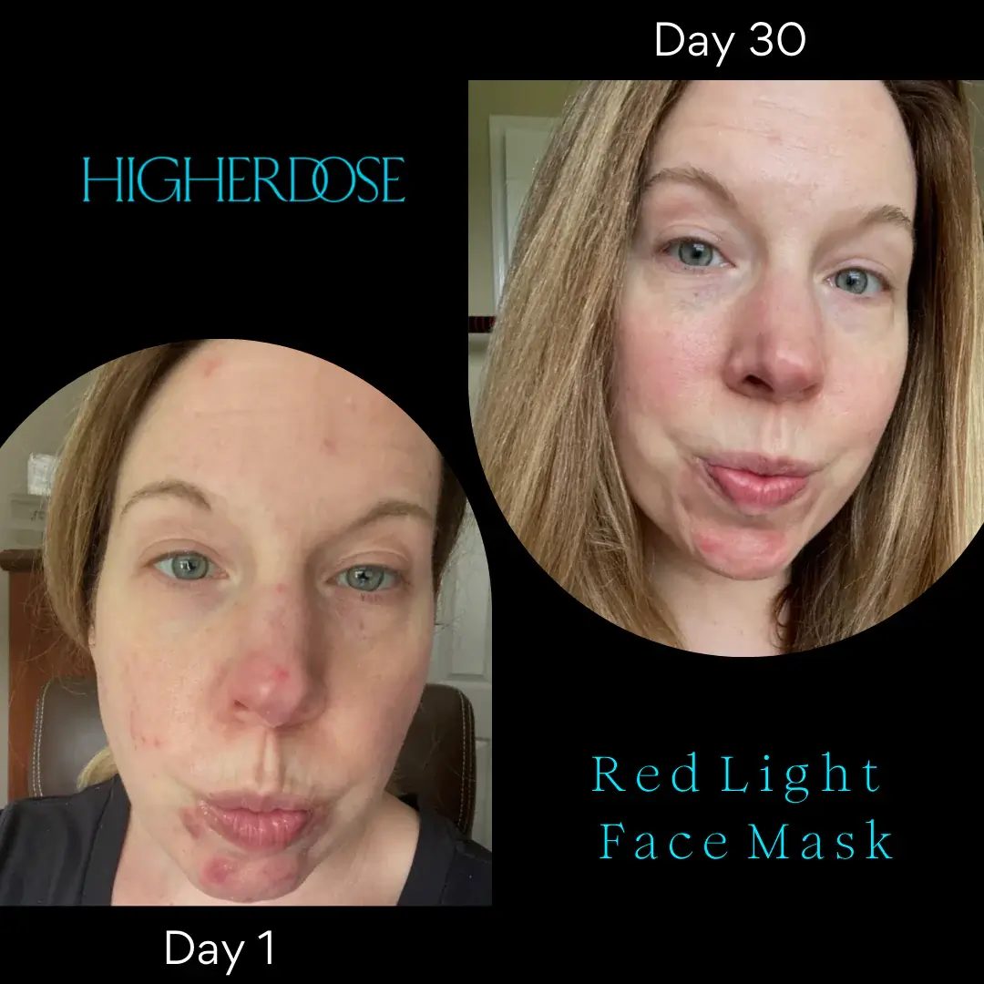 Red Light Face Mask: Rejuvenate Your Skin With HigherDOSE