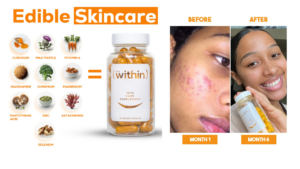 Clear Within | Reveal Radiant Skin from the Inside Out