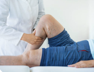 Mindful Vein Health: The Connection Between Stress and Circulation