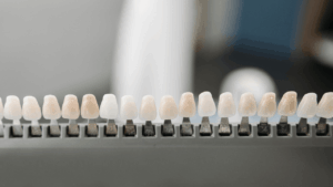 How Cosmetic Dentistry Can Transform Your Smile and Confidence