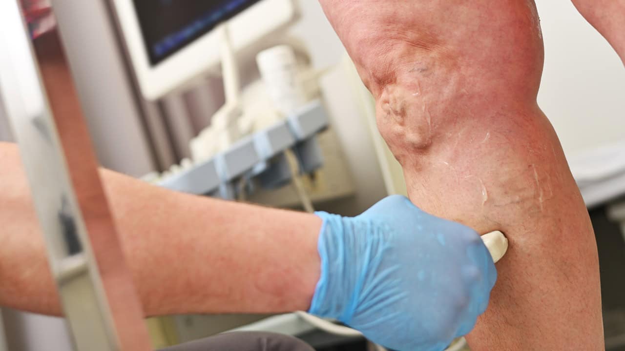 These 5 Orlando Vein Clinics Are Now Accepting New Patients